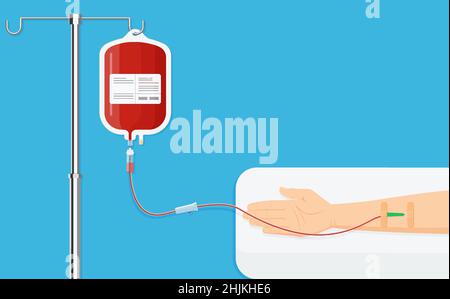 Medizinische Pipette mit Blutbeutel. Blutspendetag Konzept für Poster. Tasche mit Schlauch, Handspender. vektor-Illustration. Flaches Design. Spenden von Menschen Stock Vektor