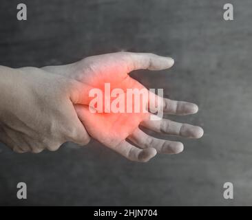 Schmerzhafter Palmar-Aspekt des asiatischen jungen Mannes. Konzept des Kompartiment-Syndroms, Zellulitis und Schmerzen der Handmuskulatur. Stockfoto