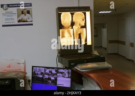 DNIPRO, UKRAINE - 31. JANUAR 2022 - Röntgenscans sind im regionalen Klinikkrankenhaus Ilya Mechnikov Dnipropetrovsk, das Verwundete behandelt, abgebildet Stockfoto