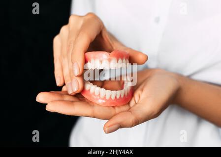 Der Zahnarzt hält Prothesen in den Händen. Zahnprothese in den Händen des Arztes Nahaufnahme. Vorderansicht der kompletten Prothese. Zahnmedizin Konzept Stockfoto