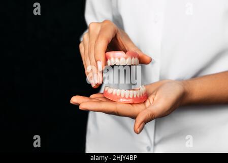 Der Zahnarzt hält Prothesen in den Händen. Zahnprothese in den Händen des Arztes Nahaufnahme. Vorderansicht der kompletten Prothese. Zahnmedizin Konzept Stockfoto