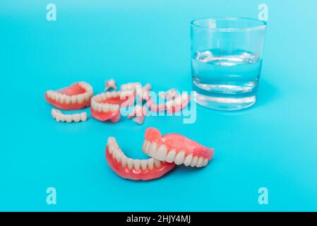 Prothesen auf blauem Hintergrund. Nahaufnahme von Prothesen. Vollständig abnehmbare Kunststoffprothese der Backen. Prothetische Zahnheilkunde. Falsche Zähne. Nahaufnahme von Plasti Stockfoto