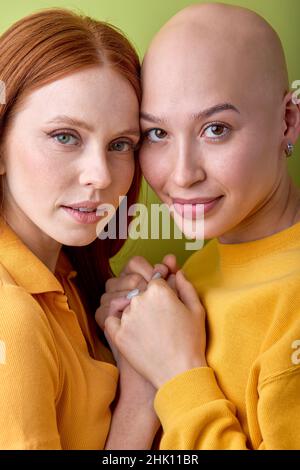 Nahaufnahme Porträt von zwei zenkfreundlichen kaukasischen kahlen und rothaarigen Frauen, die die Hände zusammenhalten und vor der Kamera posieren. Speicherplatz Kopieren. Sehr Nette Damen, Viel Spaß Mit Li Stockfoto