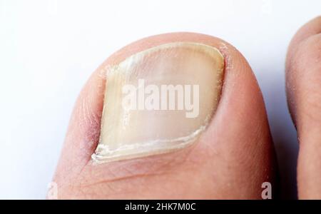 Zehen, Hände und Nägel. Männliche menschliche Körperteile 20 bis 30 Jahre alt 24Mpx Bild Stockfoto