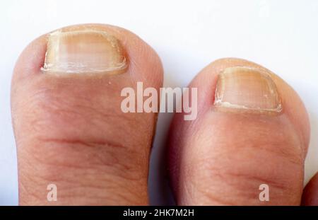 Zehen, Hände und Nägel. Männliche menschliche Körperteile 20 bis 30 Jahre alt 24Mpx Bild Stockfoto