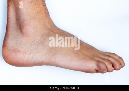 Zehen, Hände und Nägel. Männliche menschliche Körperteile 20 bis 30 Jahre alt 24Mpx Bild Stockfoto
