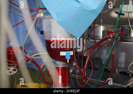 Künstlicher Blutkreislauf-Apparat voller Blut. Stockfoto