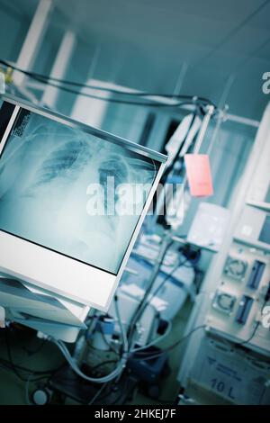 Notaufnahme mit Patient im Bett, umgeben von technischen Geräten und Röntgenbild des Brustkorbs. Stockfoto