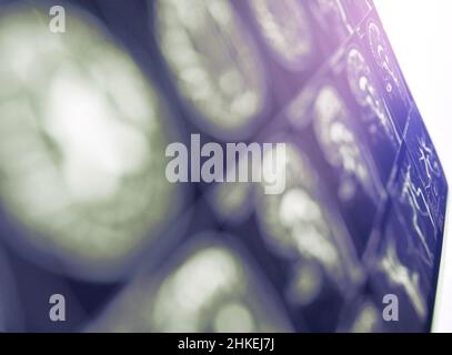 MRT-Bild des Gehirns als unfokussierter medizinischer Hintergrund. Stockfoto