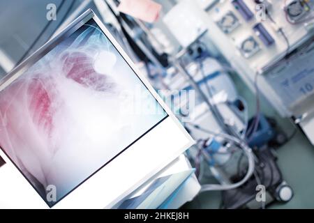 Röntgenaufnahme der Lunge auf dem Hintergrund eines hochmodernen Krankenhauszimmers mit Patient im Bett. Stockfoto