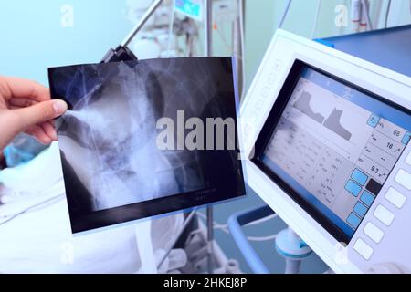 Medizinischer Monitor und das Roentgenbild in der Hand des Arztes neben dem im Bett liegenden Patienten. Stockfoto