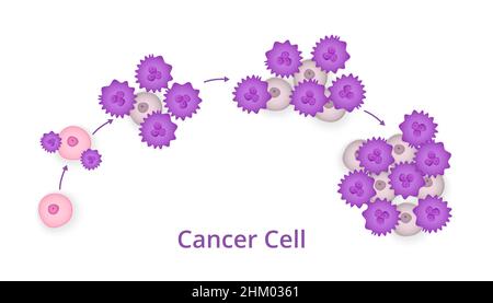 Prozess der Entwicklung von Krebszellen Stock Vektor