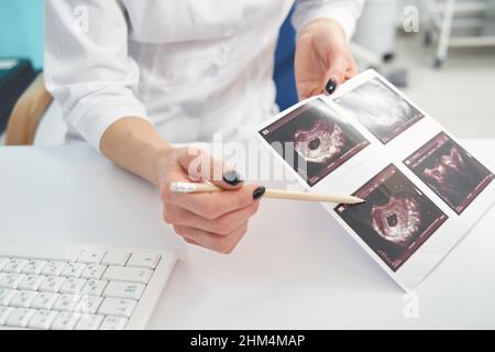 Die Ärztin demonstriert Ultraschallbilder ihrer Patientin im ersten Trimester Stockfoto