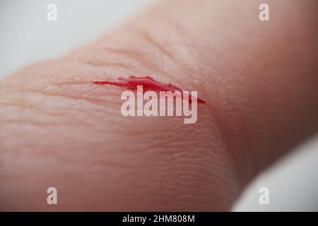 Mann mit verletzten Fingern, blutendes Blut auf offener Wunde Stockfoto