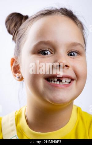 Kleines Mädchen Gesicht lächelnd mit geöffnetem Mund zeigt fehlenden vorderen Milchzahn in gelbem T-Shirt auf weißem Hintergrund. Die ersten Zähne ändern sich. Geht nach Stockfoto