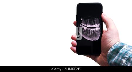 Das Röntgenbild der Kiefer auf einem Handy-Bildschirm in der Hand eines Mannes mit Kopierraum. Moderne digitale Medizin und Diagnostik Stockfoto