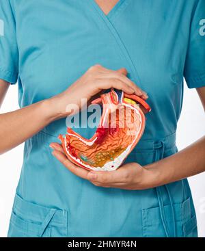 Diagnostik und Therapie der Magenkrankheit. Arzt hält anatomisches Modell des Magens mit Pathologien. Magengesundheitskonzept Stockfoto