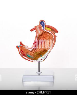 Visuelles anatomisches Modell des Magens mit Magenpathologien und Krankheiten, Geschwüren und Gastritis für die medizinische Ausbildung, Nahaufnahme Stockfoto