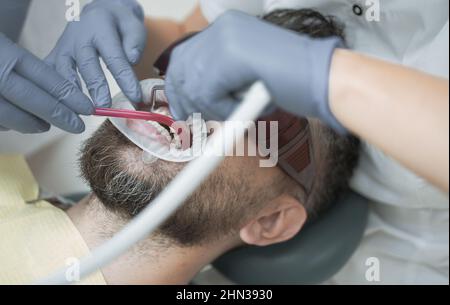 Junger Mann, der beim Zahnarzt die Farbe der Zähne auswählt, Nahaufnahme. Weibliche Zahnärztin, die die Zähne des Patienten mit Spiegel in einer modernen Zahnklinik überprüft. Gut aussehender Mann an Stockfoto