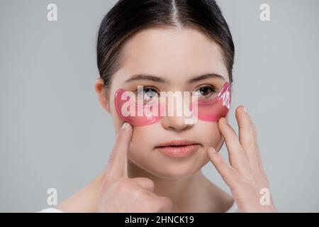 Junge Frau mit Down-Syndrom, die auf grau isolierte Augenflecken anwendet Stockfoto