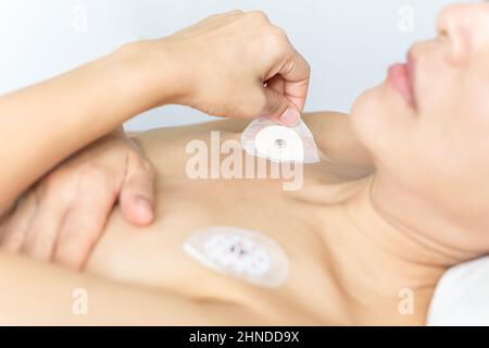 Herzelektrokardiogramm oder Überwachung mit Holter für weibliche Patienten. Stockfoto