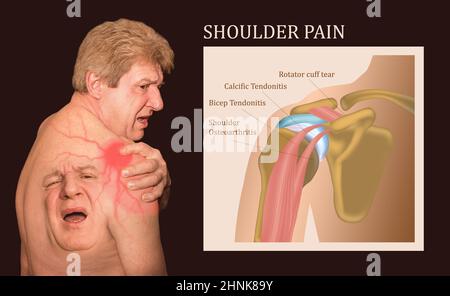 Schultergelenkstruktur beschriftet. Stockfoto