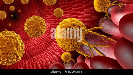 Anatomie des inneren Darms als bösartiges Tumorwachstum innerhalb eines Verdauungsorgans mit Darmzotten und Krypten. Stockfoto