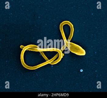 Dieser Rasterelektronenmikrograph zeigt ein einzelnes filamentöses Ebola-Viruspartikel Stockfoto