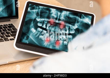 Zahnarzt Office-Digital Tablet mit einem Patienten Röntgenbilder Stockfoto