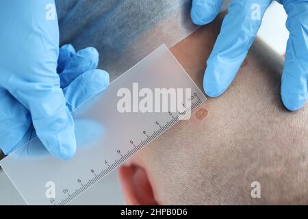 Dermatologe Arzt untersuchen Patienten Maulwurf in der Dermatologie Klinik Stockfoto