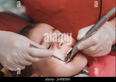 Zahnarzt reinigt Karies bei einem Kind mit einem Bohrer, in den Mund eines Kindes Ejektor Speichel, zahnärztliche Behandlung aus nächster Nähe. Stockfoto