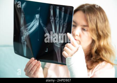 Frau mit gebrochenem Arm schaut auf ihre Röntgenaufnahme. Stockfoto