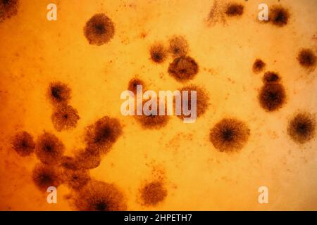 Blutanalyse mit Mikroben unter dem Mikroskop, Material professionelle Laborgeräte Stockfoto