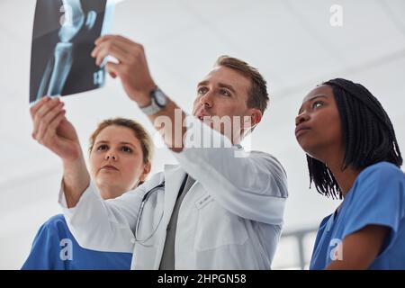 Rücksprache mit seinen Kollegen für eine zweite Meinung. Ausgeschnittene Aufnahme einer Gruppe von Ärzten, die zusammen eine Röntgenaufnahme betrachten. Stockfoto