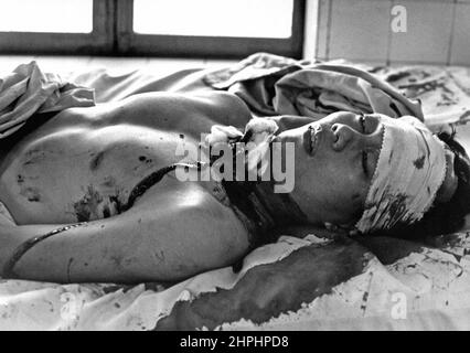 Eine von 48 Personen, die durch eine Viet Cong Explosion, bei der 14 in Saigon ums Leben kamen, verletzt wurden, erwartet eine Behandlung im Cong Hoa Krankenhaus. Blast wurde an einer belebten Straßenecke abgesetzt und zu den Opfern gehörten Frauen und Kinder ca. Februar 1966 Stockfoto
