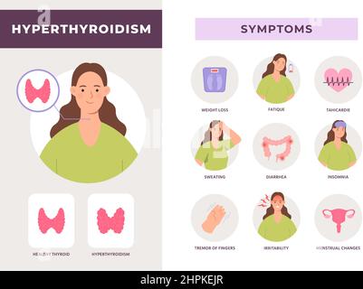 Symptome einer Schilddrüsenüberfunktion Infografik, überaktive Schilddrüsenerkrankung. Gesundheit des endokrinen Systems mit flachem Frauen-Charakter-Vektor-Poster Stock Vektor