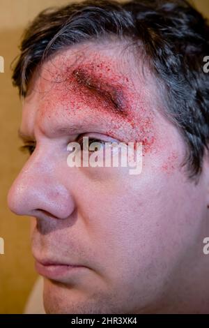 Erwachsener Mann mit Spezialeffekten, die aus einer Kopfwunde mit offener Wunde und Blutspritzer entstehen Stockfoto