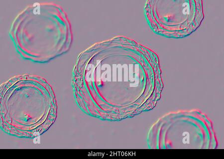 Eier von Ascaris lumbricoides Parasit, Abbildung Stockfoto