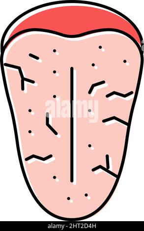 Sjogrens-Syndrom Farbe Symbol Vektor Illustration Stock Vektor