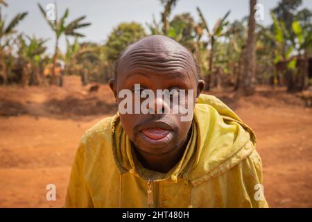 Porträt eines erwachsenen kahlen afrikanischen Mannes mit Down-Syndrom, auf einem Waldgrund Stockfoto