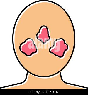 Rosacea Hautkrankheit Farbe Symbol Vektor Illustration Stock Vektor