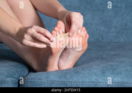 Frau klebt einen medizinischen Putz an die Plantarze des Beins, um abgestorbene Haut und Schwielen zu entfernen Stockfoto