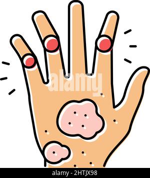 Psoriatic Arthritis Haut Gesundheit Problem Farbe Symbol Vektor Illustration Stock Vektor