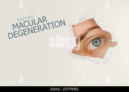 Poster zur Makuladegeneration mit Augentestdiagramm und blauem Auge. Studio grauer Hintergrund Stockfoto