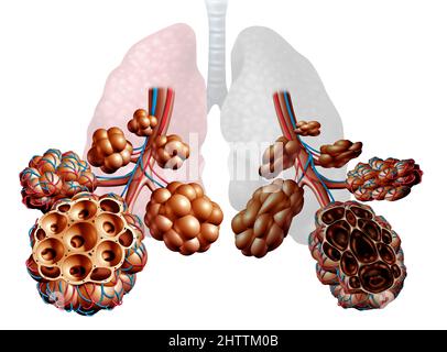 Emphysem als Kurzatmigkeit, Lungenerkrankung als COPD-Erkrankung chronisch obstruktive Lungenerkrankung medizinisches Konzept wie Bronchiolen und Alveolen. Stockfoto