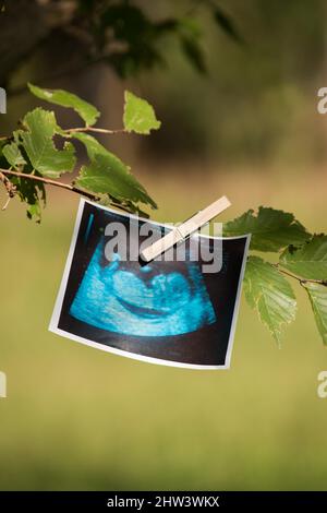 Ultraschallbild. Nachrichten von einer Schwangerschaft Stockfoto