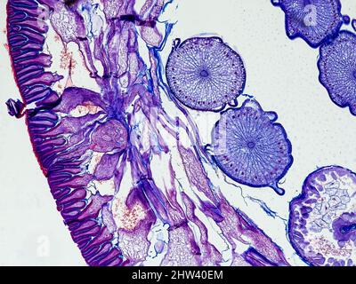 ascaris megalocephala Querschnitt unter dem Mikroskop zeigt seine Nagelhaut, mesodermalen Zellen, Pseudozelom und Eierstöcke - optisches Mikroskop x100 mag Stockfoto