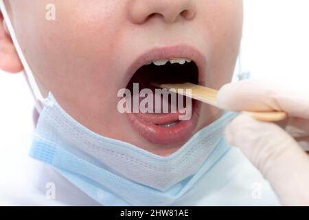 Ein Zahnarzt mit Gummihandschuhen untersucht den Mund des Kindes mit einem speziellen Werkzeug. Die Gesundheit des Kindes. Kranke Zähne Stockfoto