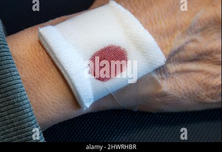Ältere männliche Hand, weiß mit blutbefleckter Bandage Stockfoto