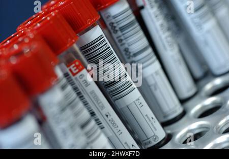 Proben von Blutspenden in Vacutainer Reagenzgläser mit roten Spitzen Stockfoto